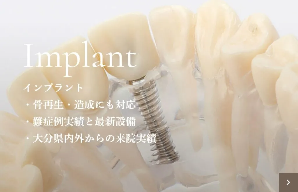 Implant インプラント ・骨再生・造成にも対応・難症例実績と最新設備 ・大分県内外からの来院実績｜大分の歯医者・矯正歯科「リッツ歯科・矯正歯科大分駅前」