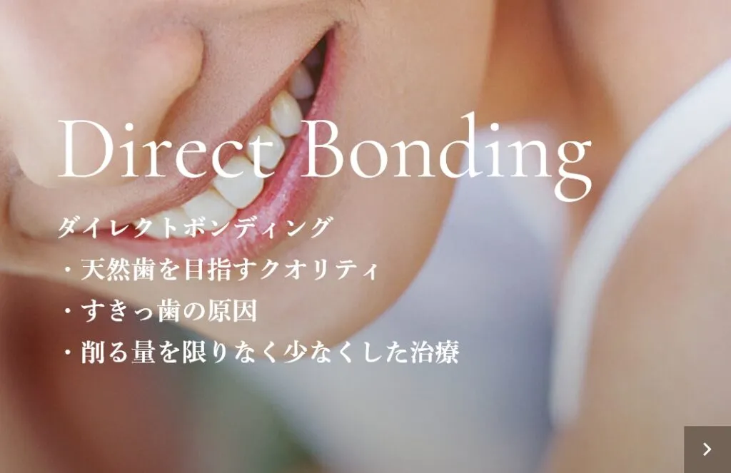 Direct Bonding ダイレクトボンディング・天然歯を目指すクオリティ・すきっ歯の原因・削る量を限りなく少なくした治療｜大分の歯医者・矯正歯科「リッツ歯科・矯正歯科大分駅前」