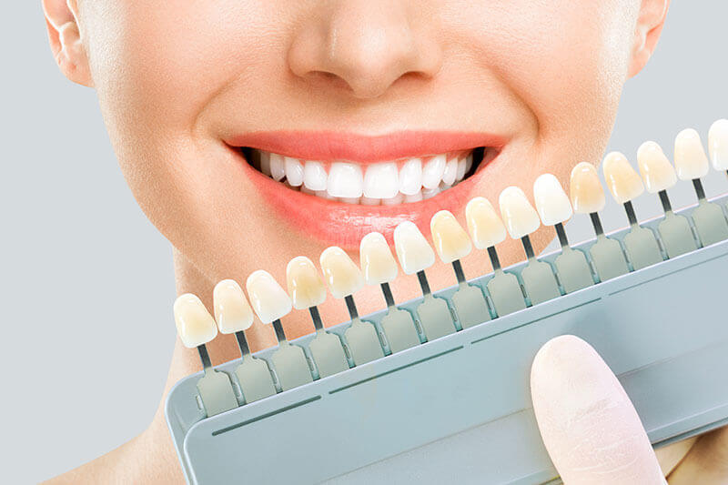 白い歯は透明感ある素肌を演出します​