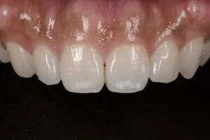 術前|大分の歯医者・矯正歯科「リッツ歯科・矯正歯科大分駅前」